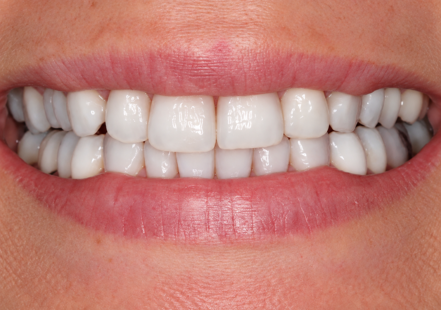 Bright Clinical Smile Close Up 1