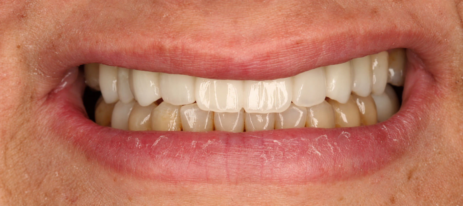 Clinical Close Up Smile