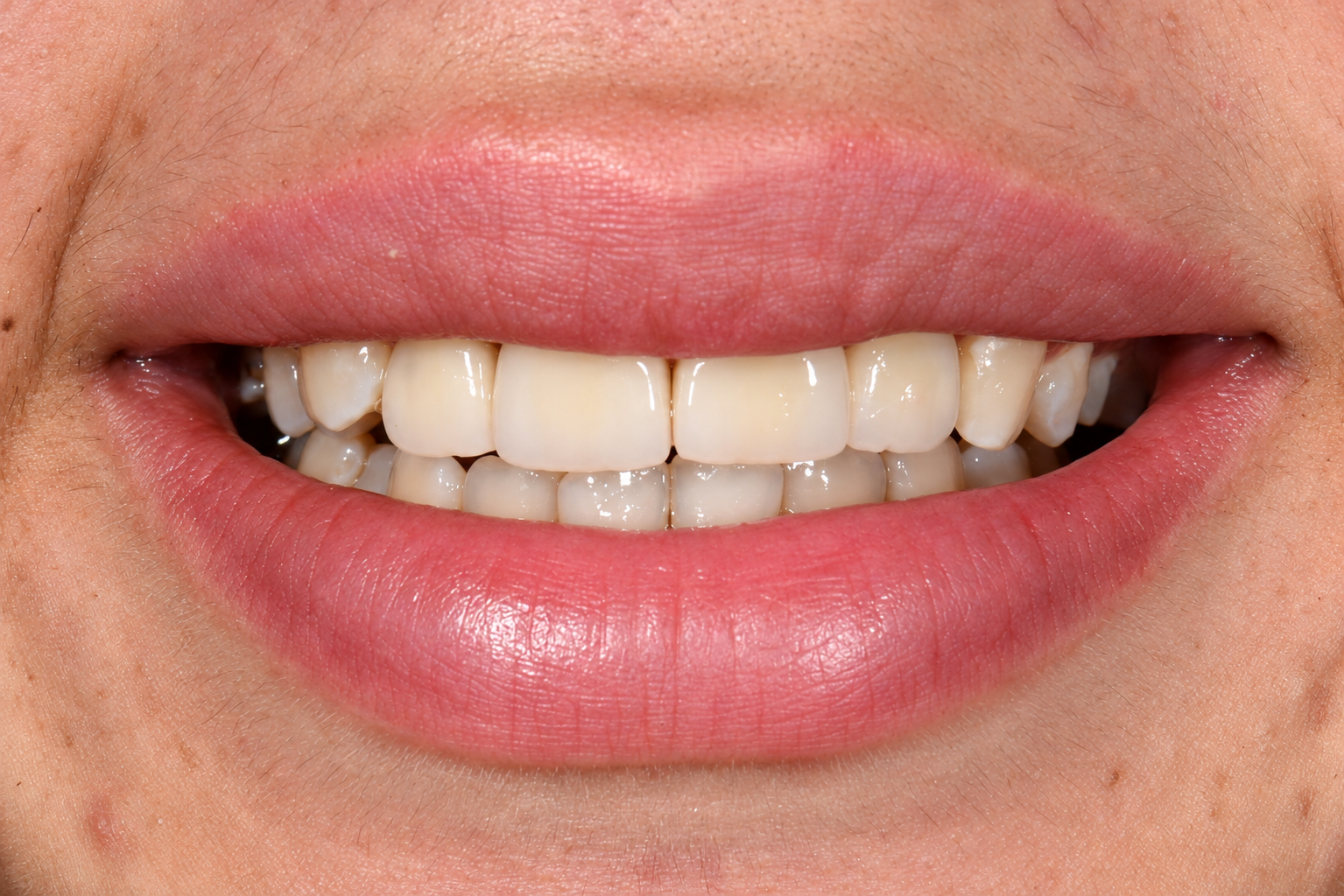 Close Up Natural Smile Portrait