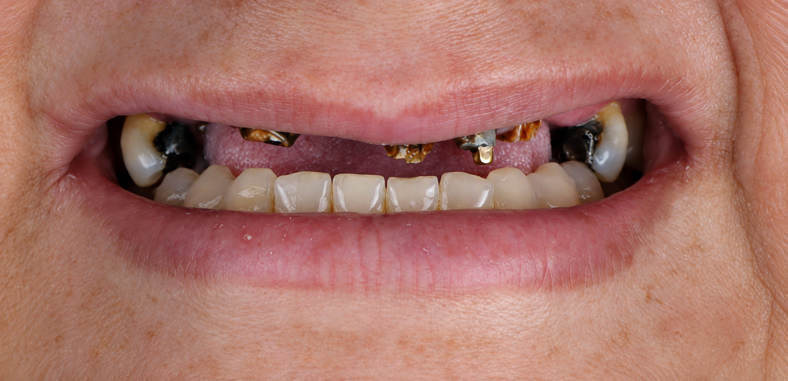 Detailed Clinical Dental Smile