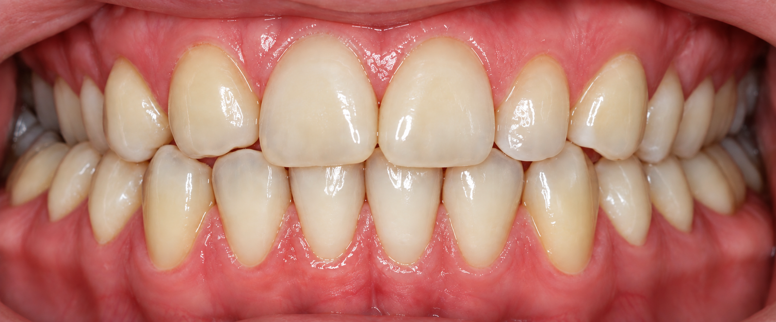 Natural Ivory Smile Close Up